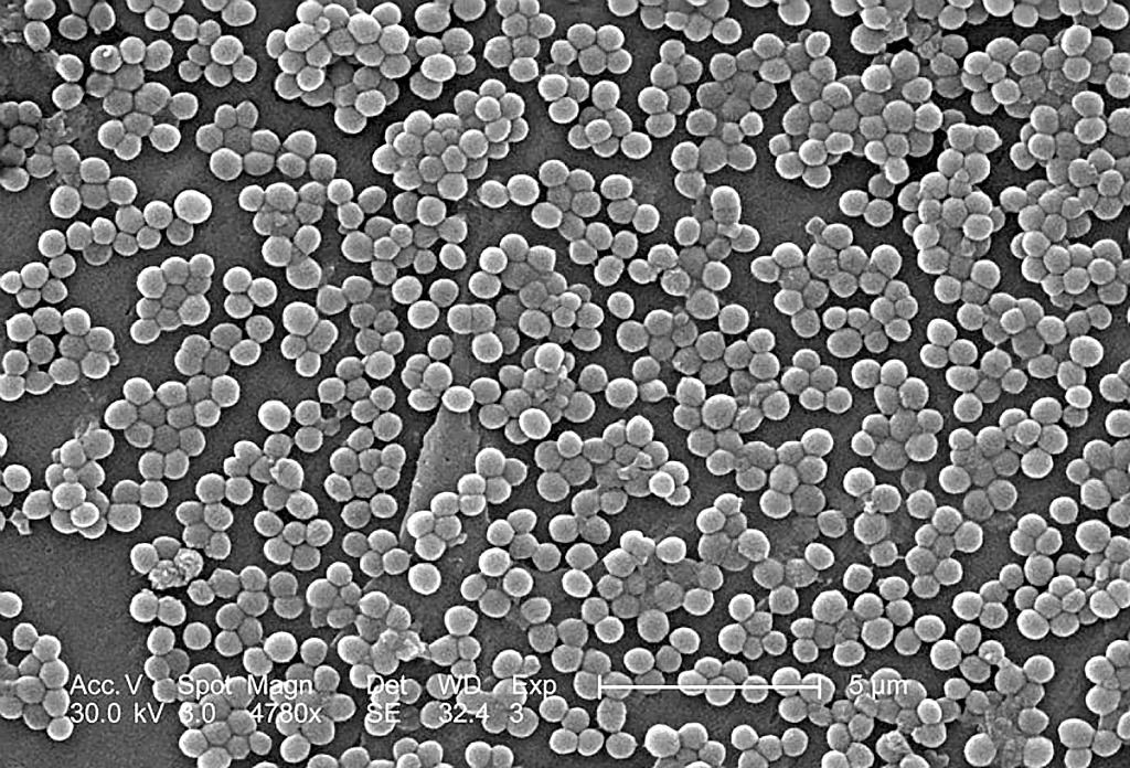 Staphylococcus aureus MRSA, magnified 4780 times by an electron microscope, has multiple resistance to antibiotics.